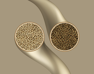 Imunita - Kosti - Zuby 